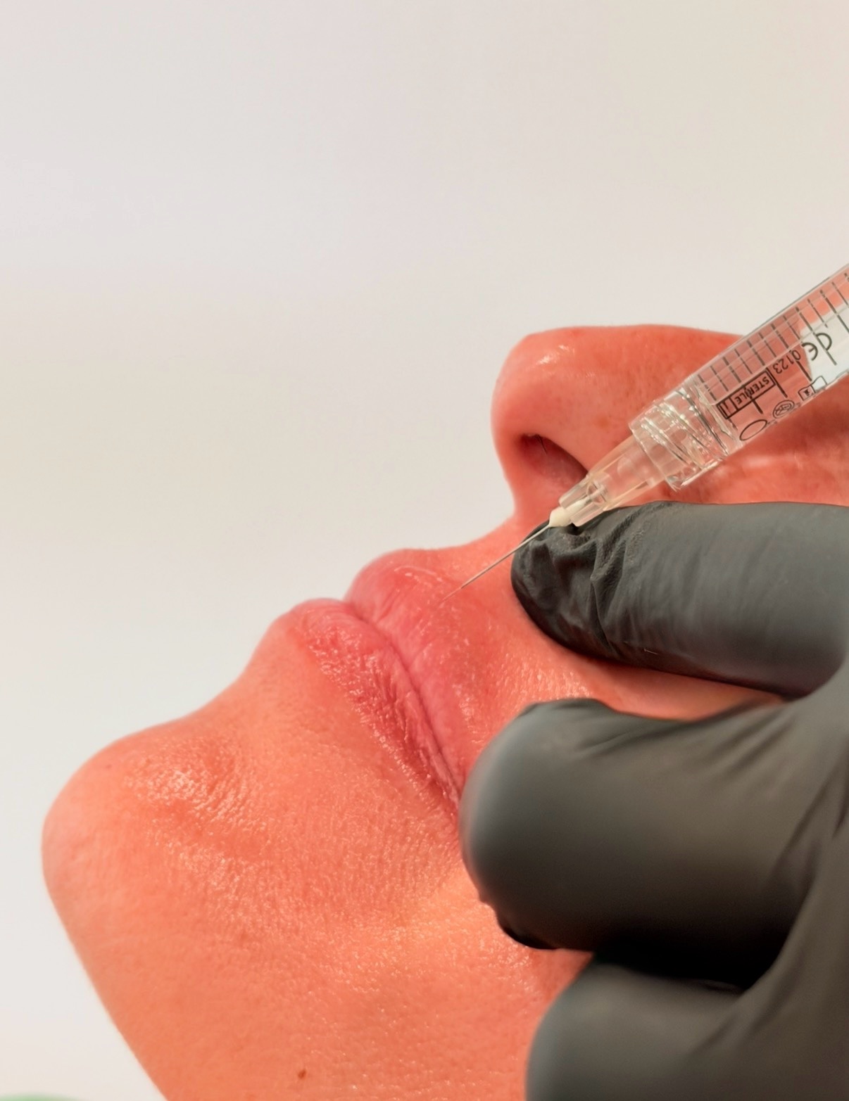 Medicina estética facial